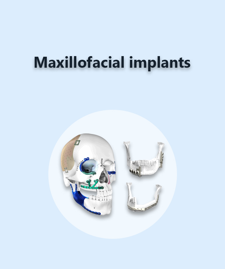 Cranio-maxillofacial implants
