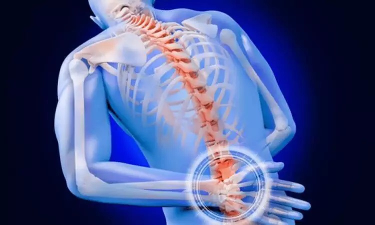 Back Surgery: When Do We Need One?
